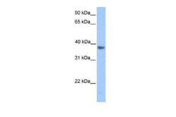 MATH2/NEUROD6 Rabbit anti-Human, Polyclonal, Novus Biologicals 100 &mu;g | Buy Online | Novus Biologicals | Fisher Scientific